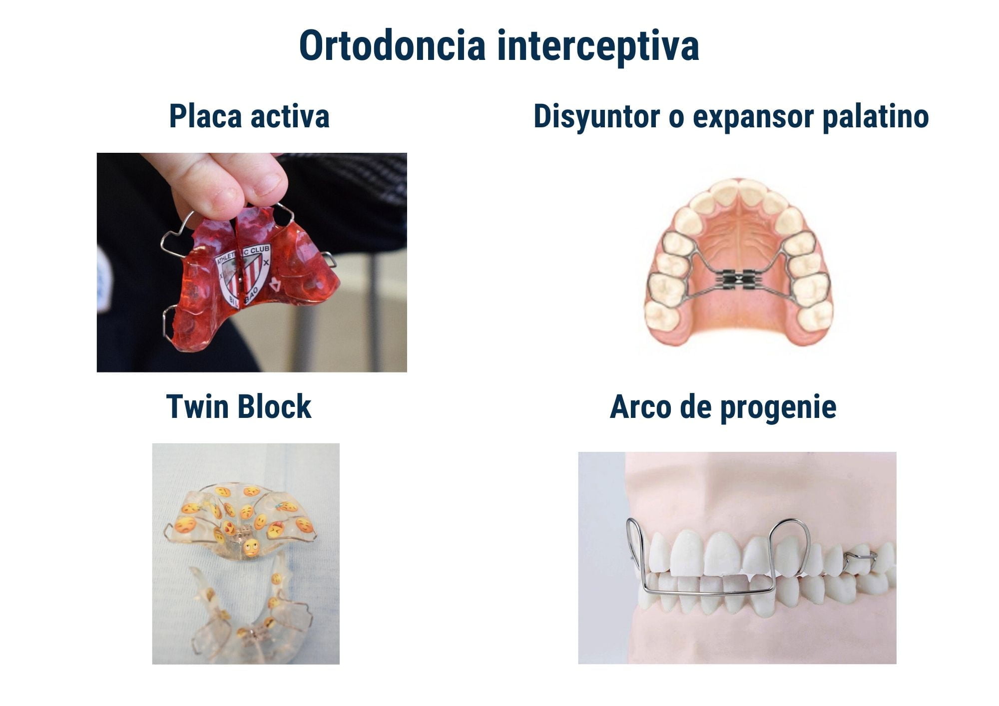 Guía de ortodoncia interceptiva Clínica Ortiz Vigón