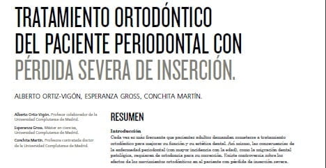 Tratamiento ortodontico artículo