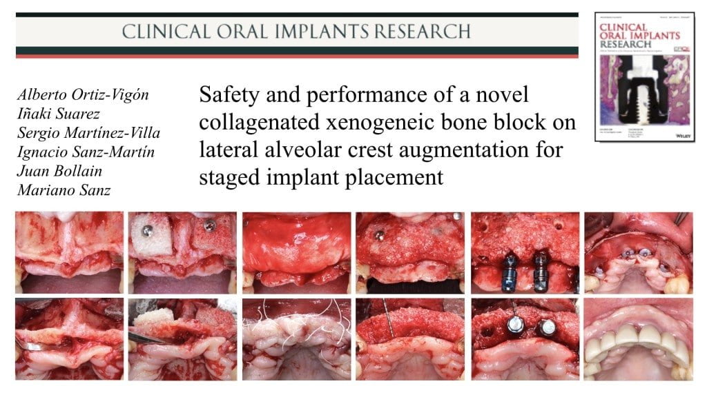 Clinical Oral Implants Research