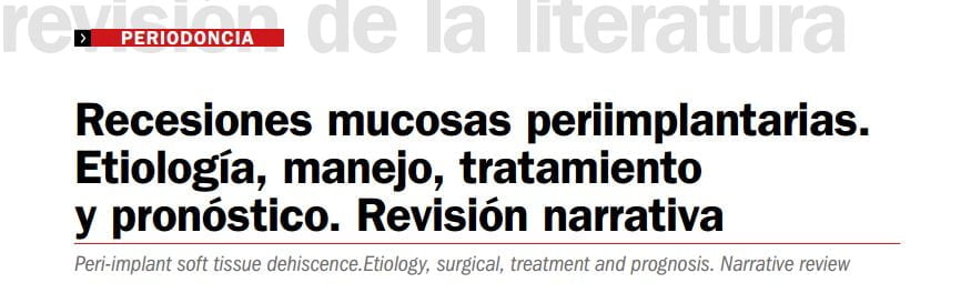 Artículo de investigación sobre Recesiones Mucosas Periimplantarias de los doctores Regidor, Navarro y Ortiz-Vigón