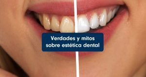 Verdades y mitos sobre estética dental