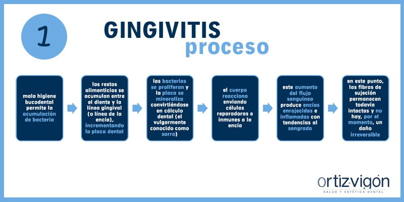 Gingivitis: el abc de las enfermedades periodontales