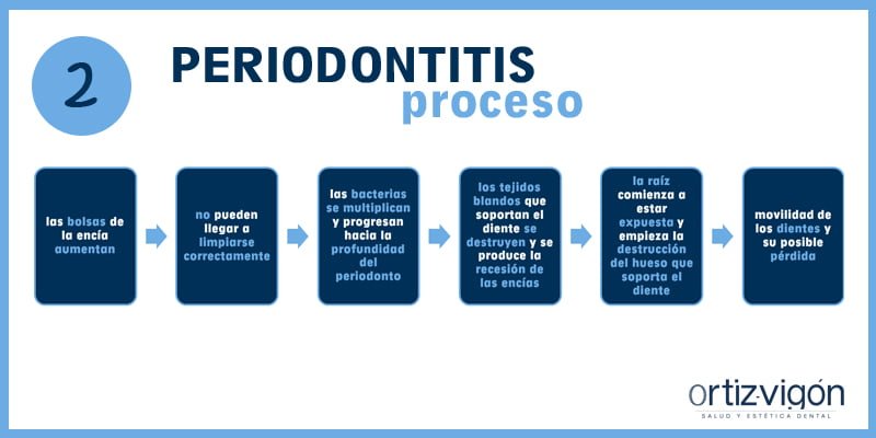 Periodontitis: el abc de las enfermedades periodontales