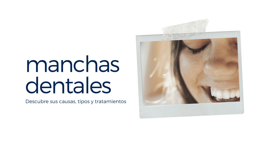 Manchas dentales