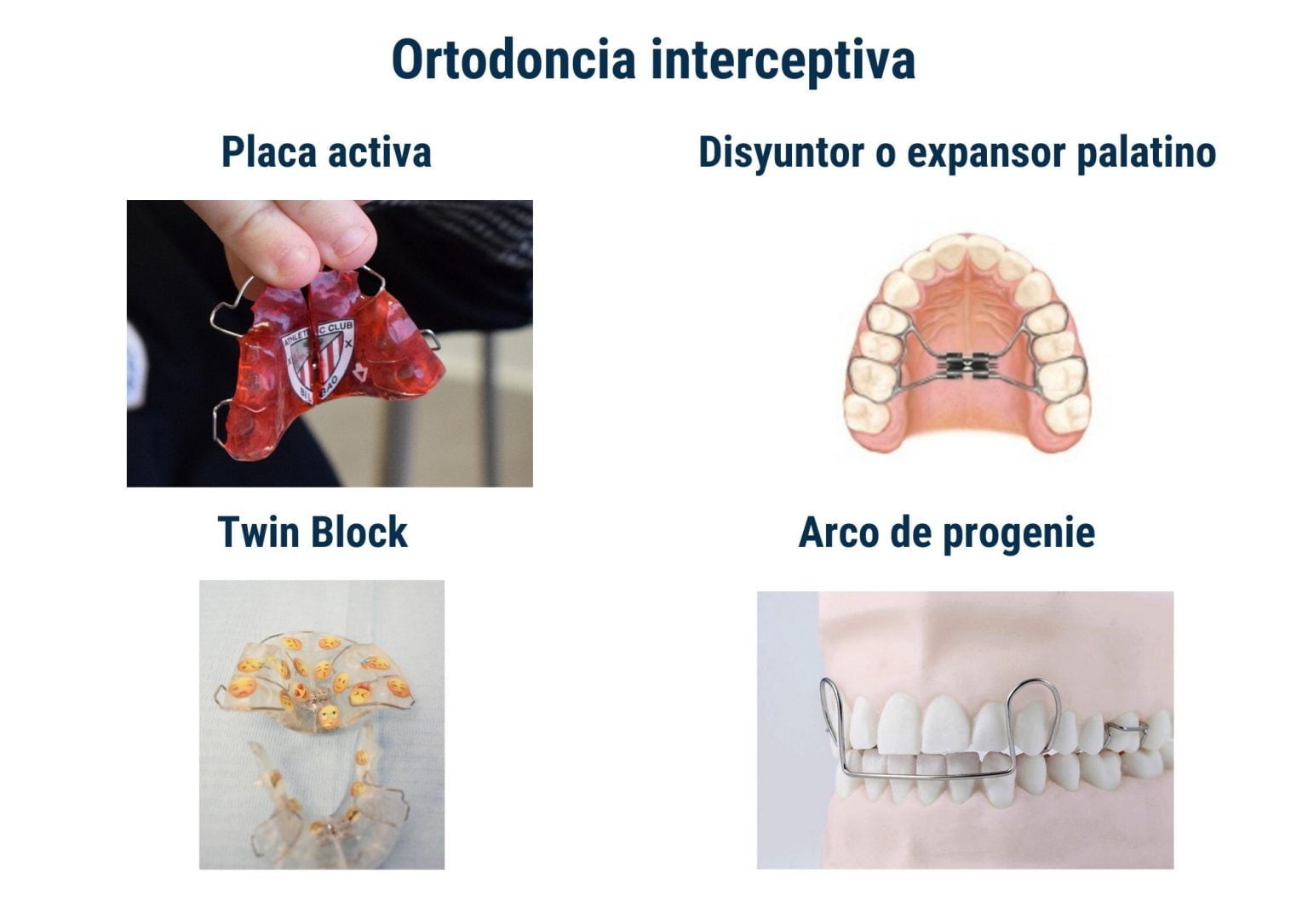 Gu A De Ortodoncia Interceptiva Cl Nica Ortiz Vig N