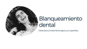 Blanqueamiento dental Ortiz-Vigon (2)