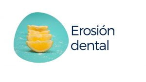 erosion dental ortizvigon