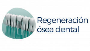 regeneracion osea dental
