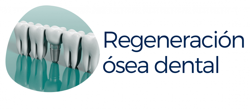 regeneracion osea dental