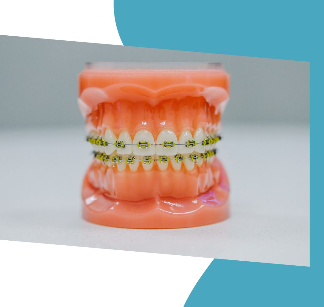 ortodoncia en pacientes con periodontitis