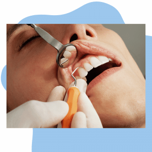 Revisión periodontal