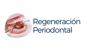 Regeneración periodontal